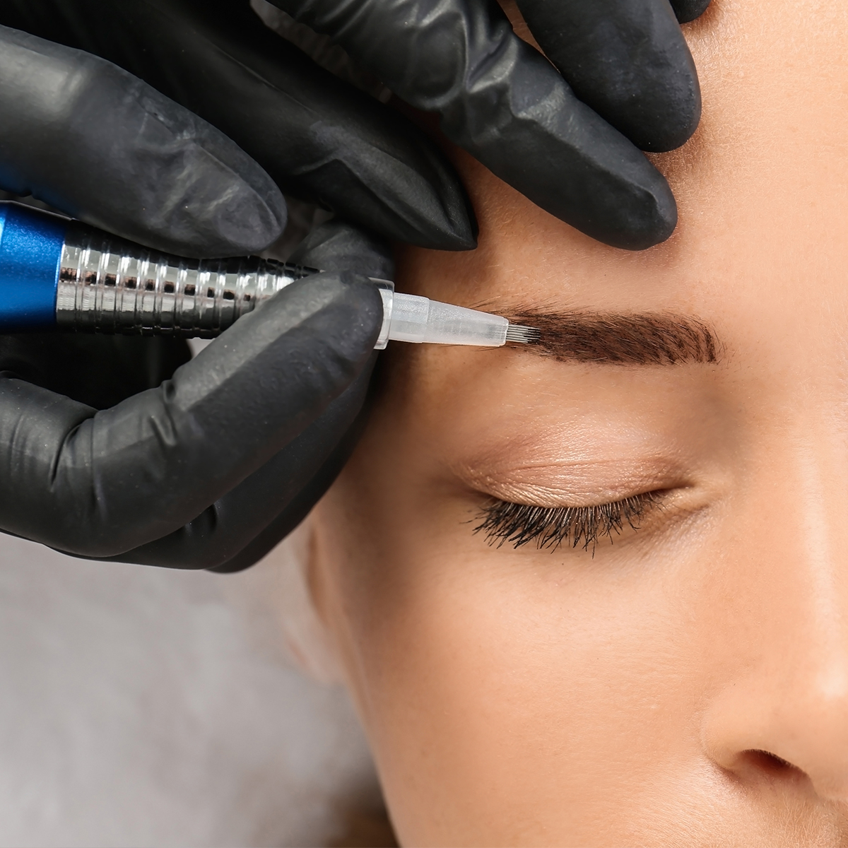 Oberschenkelstraffung